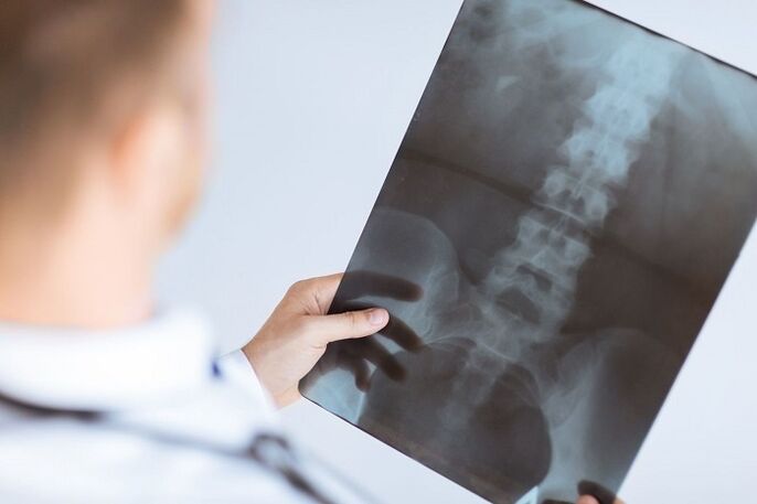 Diagnoseoptionen für die lumbale Osteochondrose