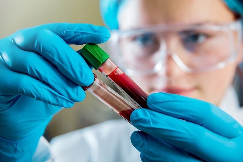 Vollständiger Bluttest zur Diagnose von Rückenschmerzen.