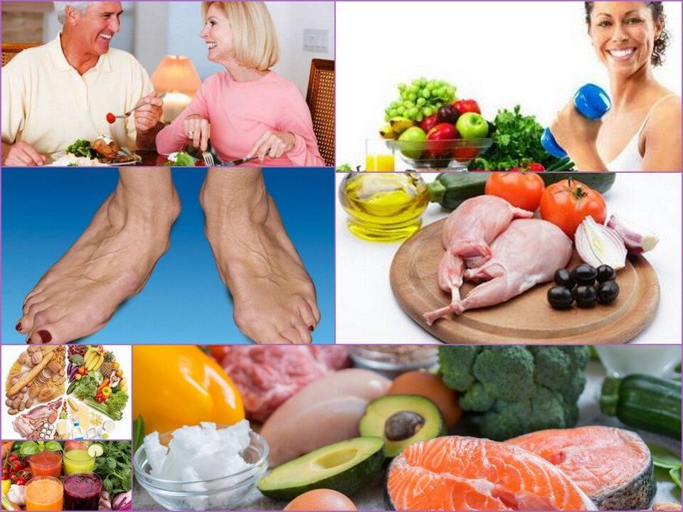 Ernährungsgrundsätze für Menschen mit Arthrose des Kniegelenks.