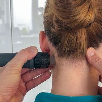Stoßwellenbehandlung bei Nackenschmerzen